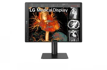 LG 21.3” 3MP IPS DIAGNOSTIC MONITOR